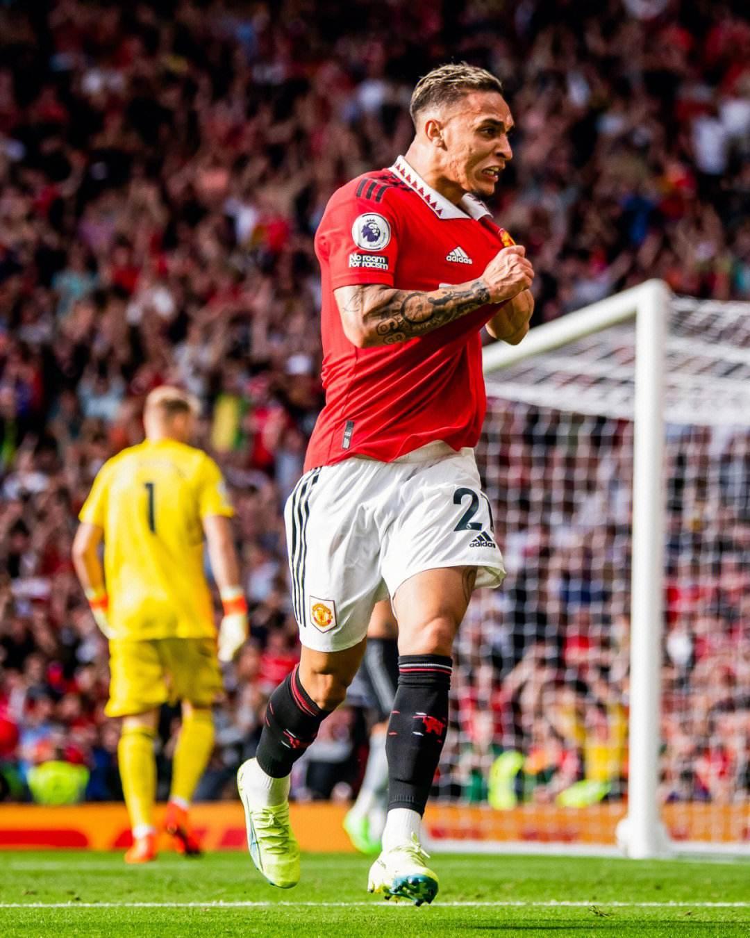 孔蒂：因为伤病我们的中场已经空了，希望坏运气能离我们远去